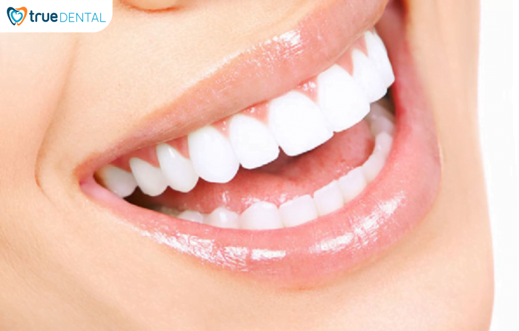 RĂNG SỨ - PHƯƠNG PHÁP THẨM MỸ NHA KHOA ĐƯỢC ƯA CHUỘNG NHẤT HIỆN NAY