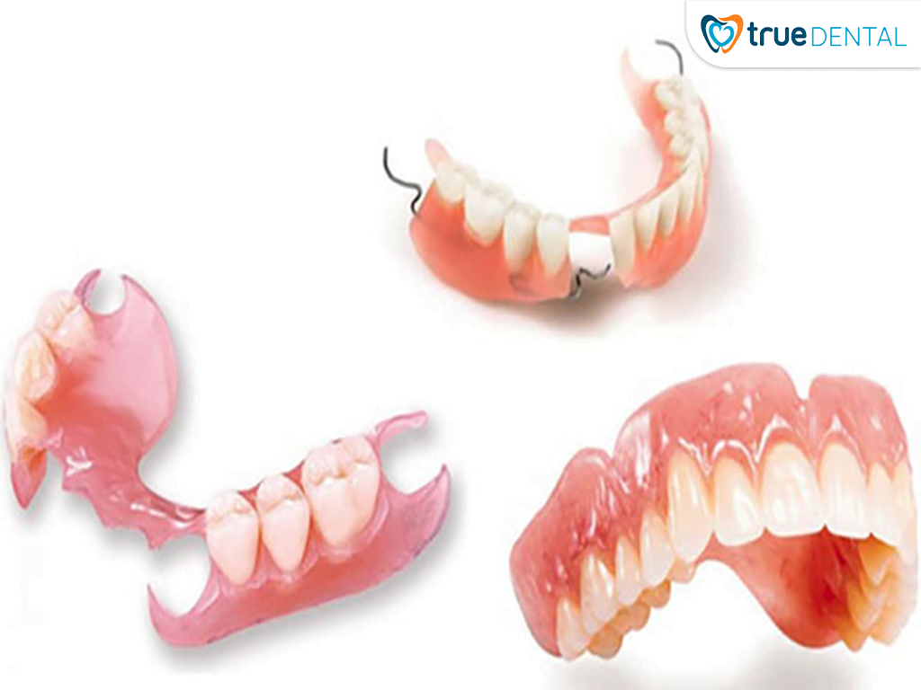 PHỤC HÌNH RĂNG BẰNG HÀM GIẢ THÁO LẮP