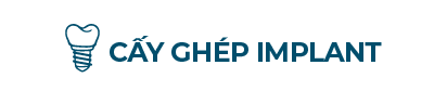 Cay Ghep IMPLANT