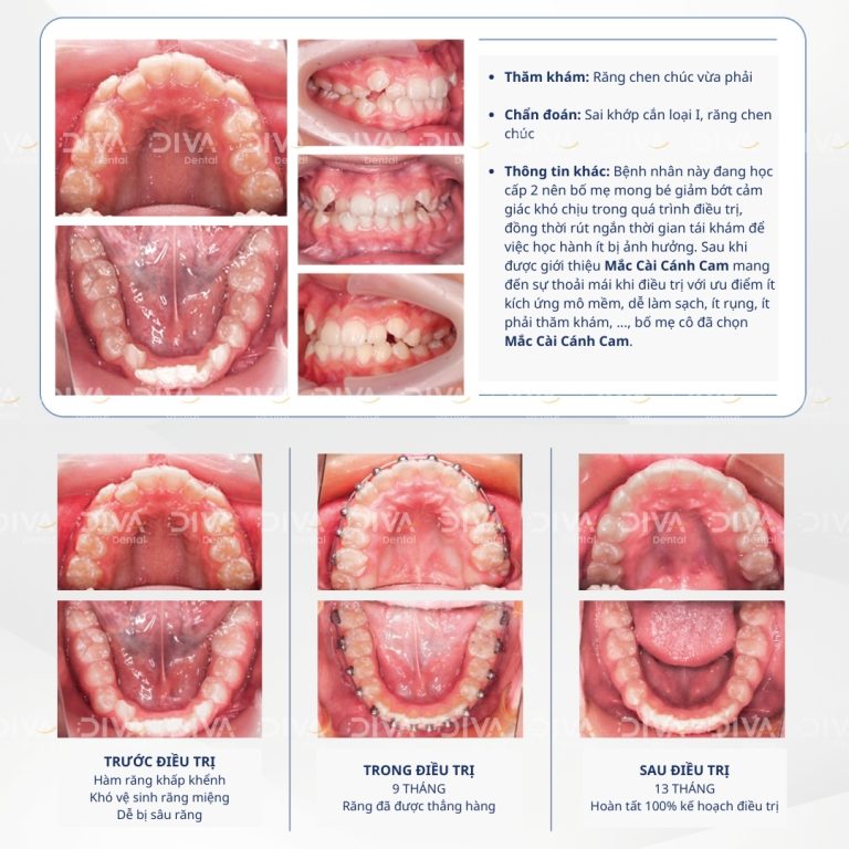 Case 1 2