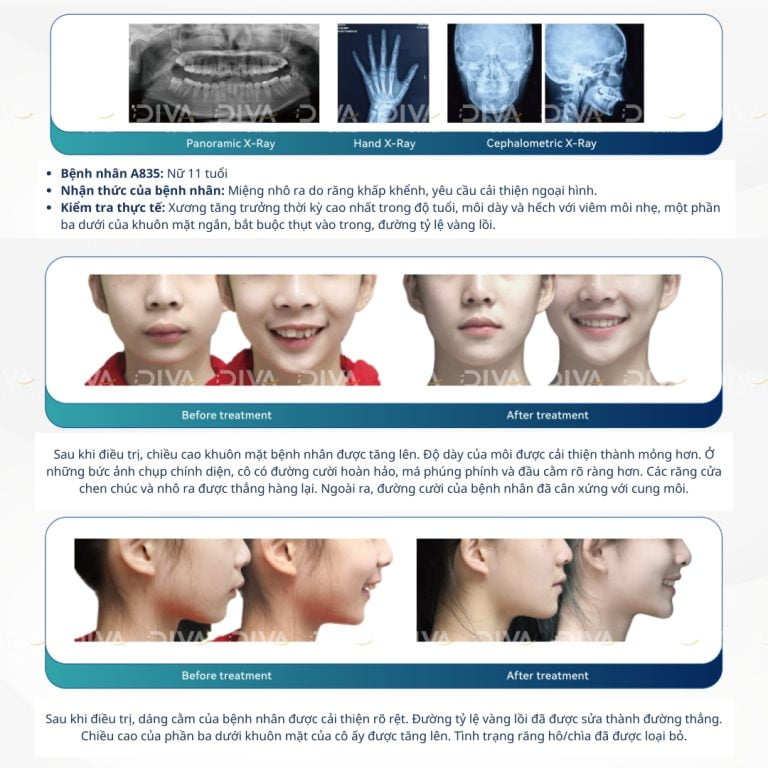 Case 2