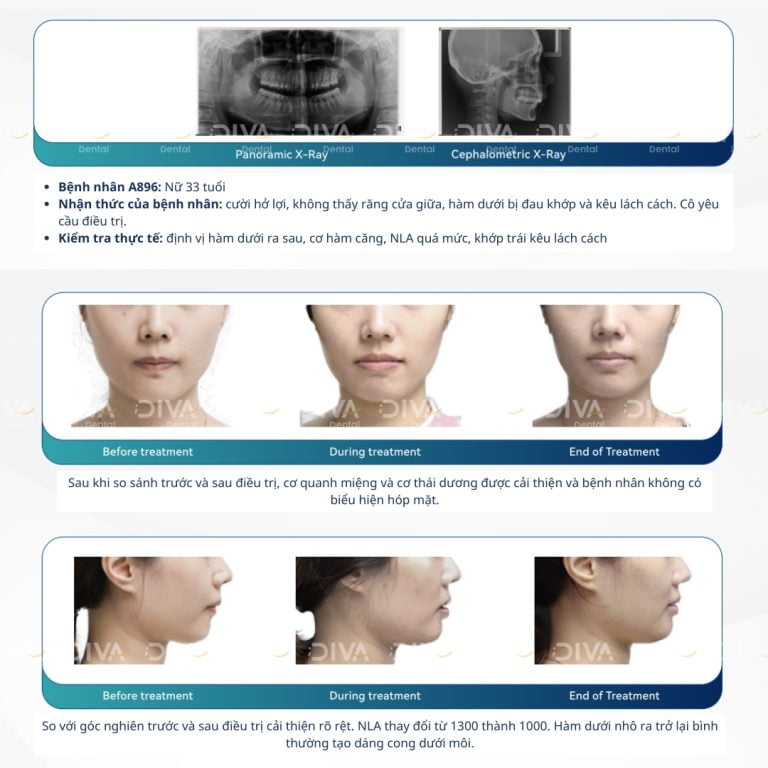 Case 5