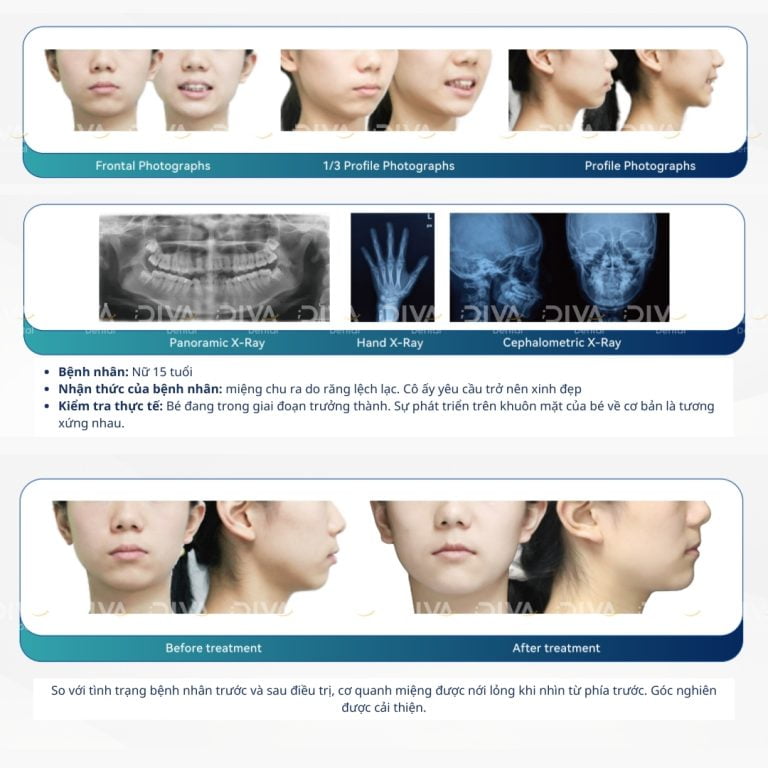 Case 6 1