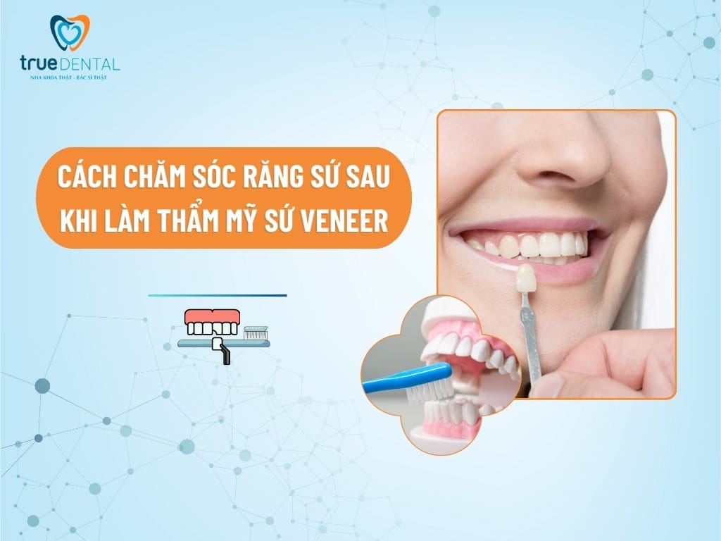 CÁCH CHĂM SÓC RĂNG SỨ SAU KHI LÀM THẨM MỸ SỨ VENEER