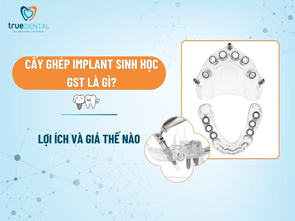 cay ghep implant sinh hoc gst la gi