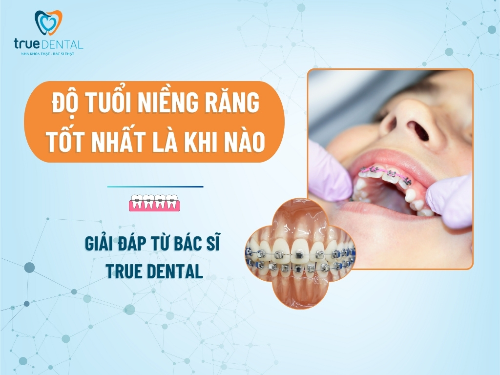ĐỘ TUỔI NIỀNG RĂNG TỐT NHẤT LÀ KHI NÀO?