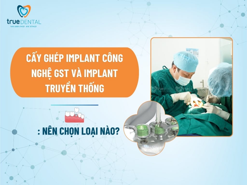 CẤY GHÉP IMPLANT CÔNG NGHỆ GST VÀ IMPLANT TRUYỀN THỐNG: NÊN CHỌN LOẠI NÀO?