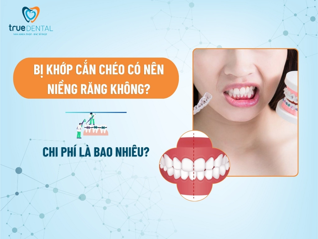 khop can cheo co nen nieng rang khong