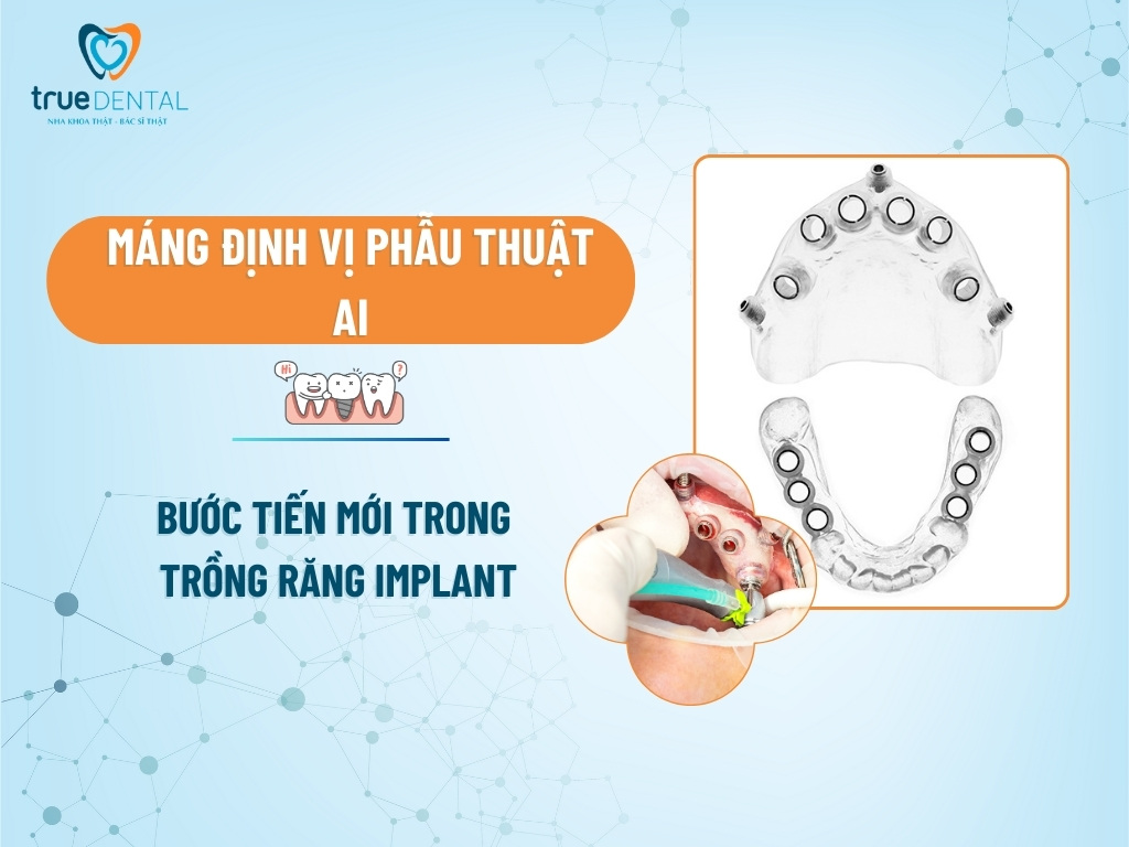 MÁNG ĐỊNH VỊ PHẪU THUẬT AI