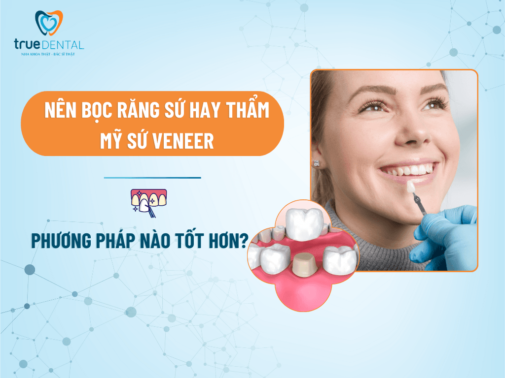 NÊN BỌC RĂNG SỨ HAY THẨM MỸ SỨ VENEER? PHƯƠNG PHÁP NÀO TỐT HƠN?