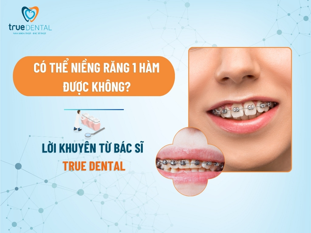 CÓ THỂ NIỀNG RĂNG 1 HÀM ĐƯỢC KHÔNG? LỜI KHUYÊN TỪ BÁC SĨ TRUE DENTAL