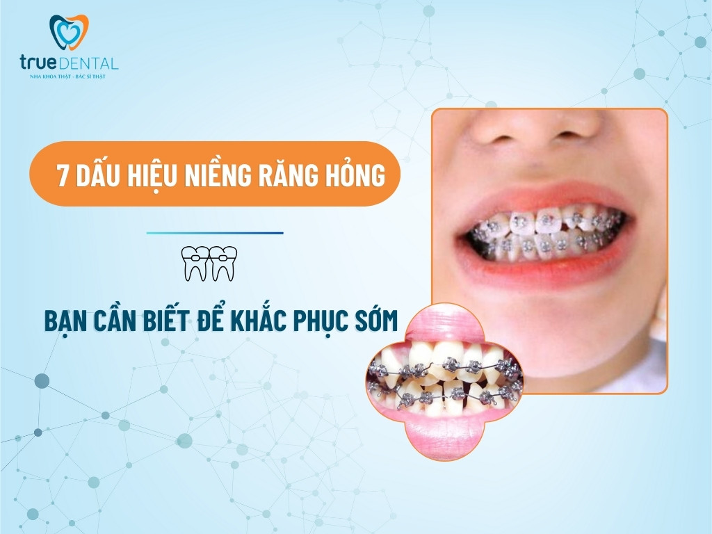 7 DẤU HIỆU NIỀNG RĂNG HỎNG BẠN CẦN BIẾT ĐỂ KHẮC PHỤC SỚM