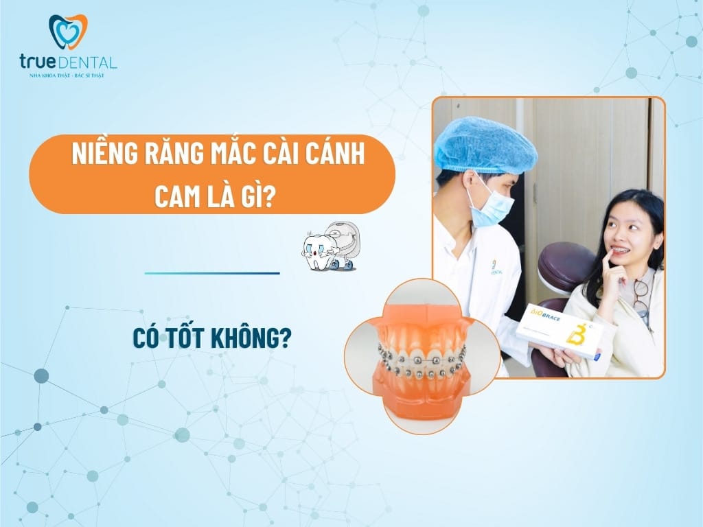 nieng rang mac cai canh cam la gi