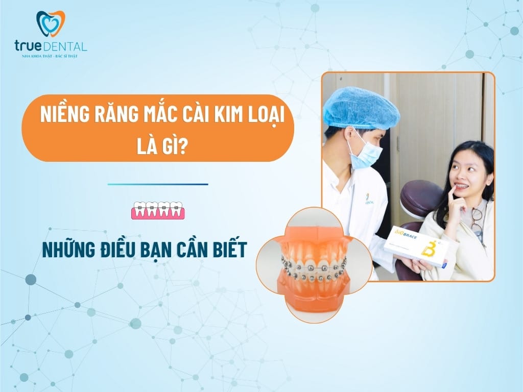 nieng rang mac cai kim loai la gi