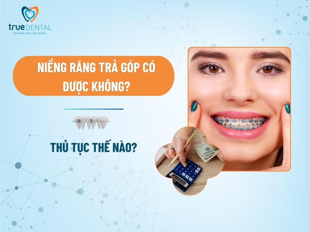 NIỀNG RĂNG TRẢ GÓP CÓ ĐƯỢC KHÔNG? THỦ TỤC THẾ NÀO