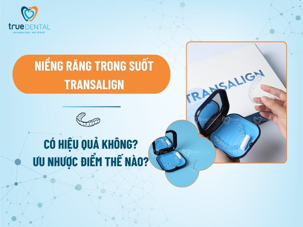 NIỀNG RĂNG TRONG SUỐT TRANSALIGN CÓ HIỆU QUẢ KHÔNG? ƯU VÀ NHƯỢC ĐIỂM