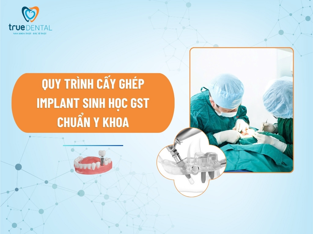 quy trình cấy ghép implant sinh học gst chuẩn y khoa