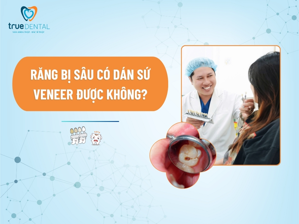 RĂNG BỊ SÂU CÓ DÁN SỨ VENEER ĐƯỢC KHÔNG?