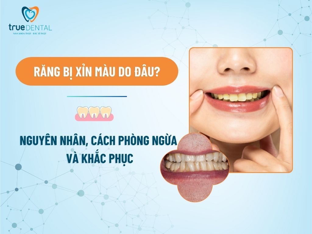 Răng bị xỉn màu do đâu? Nguyên nhân, cách phòng ngừa và khắc phục 3 RĂNG BỊ XỈN MÀU DO ĐÂU? NGUYÊN NHÂN, CÁCH PHÒNG NGỪA VÀ KHẮC PHỤC