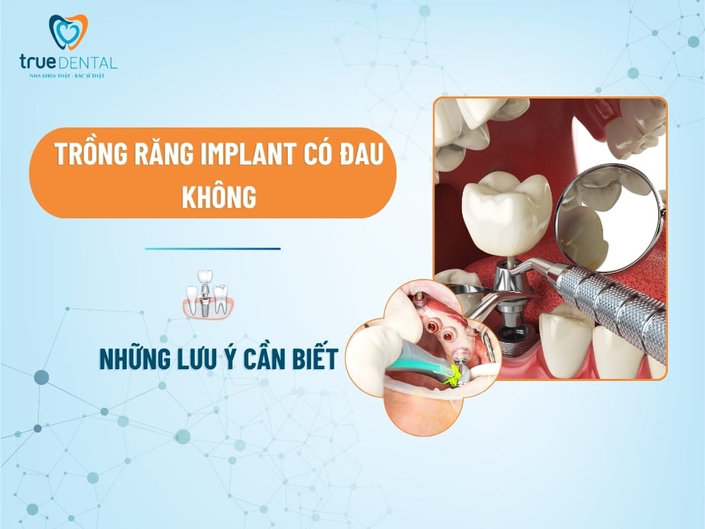 TRỒNG RĂNG IMPLANT CÓ ĐAU KHÔNG? NHỮNG LƯU Ý CẦN BIẾT