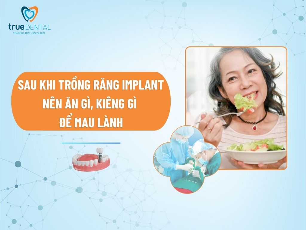 SAU KHI TRỒNG RĂNG IMPLANT NÊN ĂN GÌ, KIÊNG GÌ ĐỂ MAU LÀNH