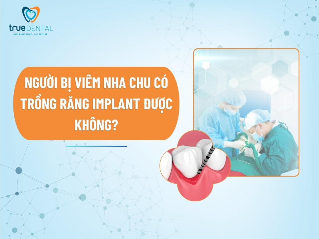 NGƯỜI BỊ VIÊM NHA CHU CÓ TRỒNG RĂNG IMPLANT ĐƯỢC KHÔNG?