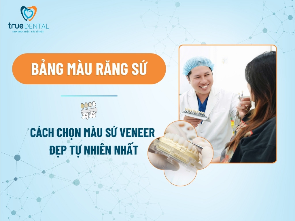 BẢNG MÀU RĂNG SỨ VÀ CÁCH CHỌN MÀU SỨ VENEER ĐẸP TỰ NHIÊN NHẤT