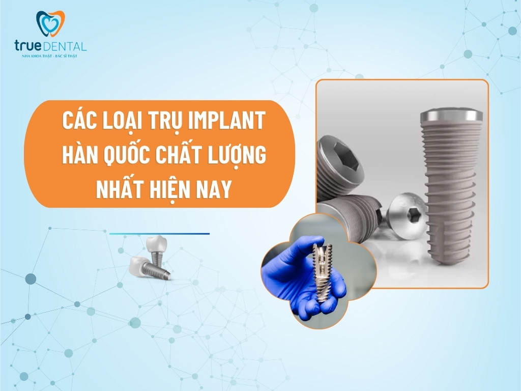 CÁC LOẠI TRỤ IMPLANT HÀN QUỐC CHẤT LƯỢNG NHẤT HIỆN NAY