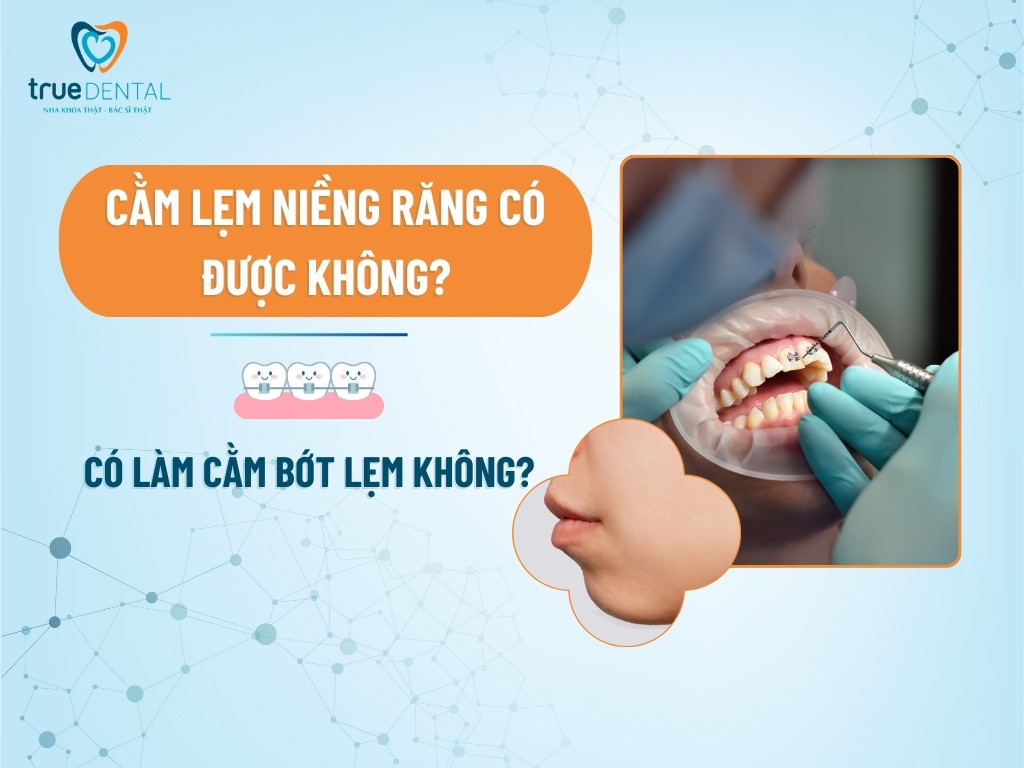 CẰM LẸM NIỀNG RĂNG CÓ ĐƯỢC KHÔNG? CÓ LÀM CẰM BỚT LẸM KHÔNG?