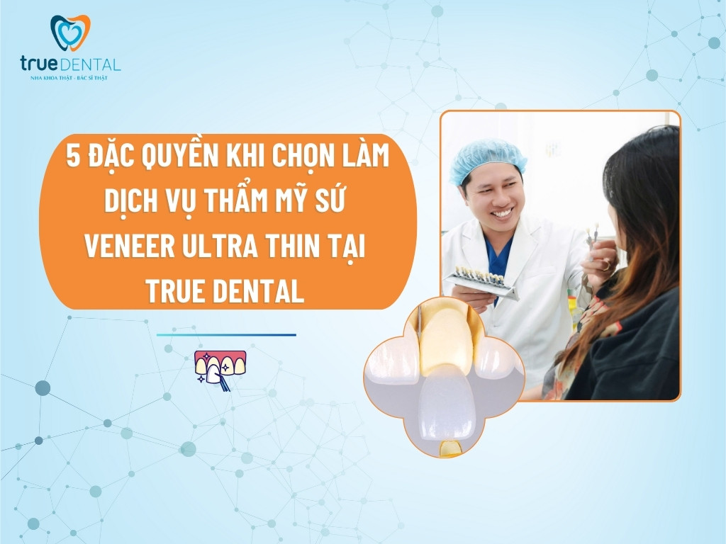 5 ĐẶC QUYỀN KHI CHỌN LÀM DỊCH VỤ THẨM MỸ SỨ VENEER ULTRA THIN TẠI TRUE DENTAL