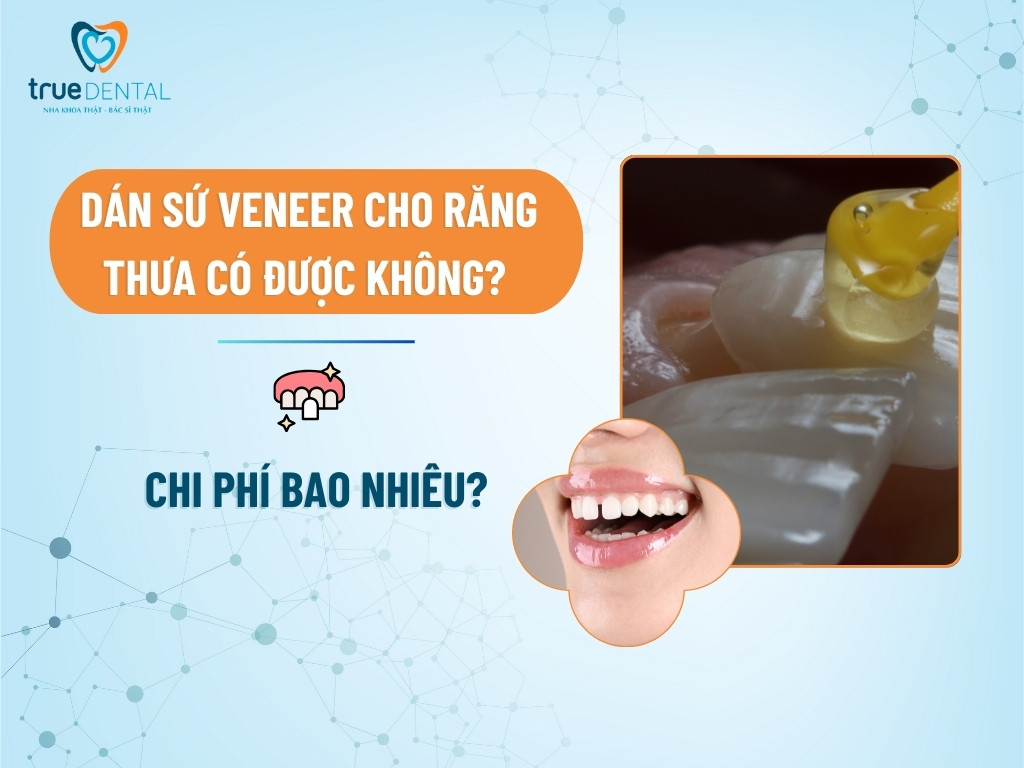 DÁN SỨ VENEER CHO RĂNG THƯA CÓ ĐƯỢC KHÔNG? CHI PHÍ BAO NHIÊU?