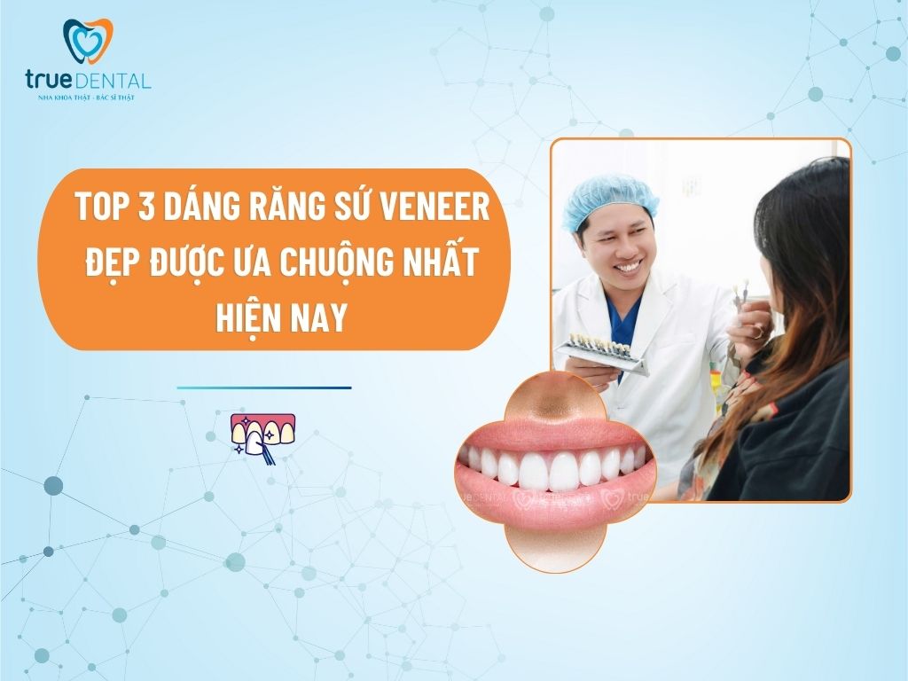 dang rang su veneer 1