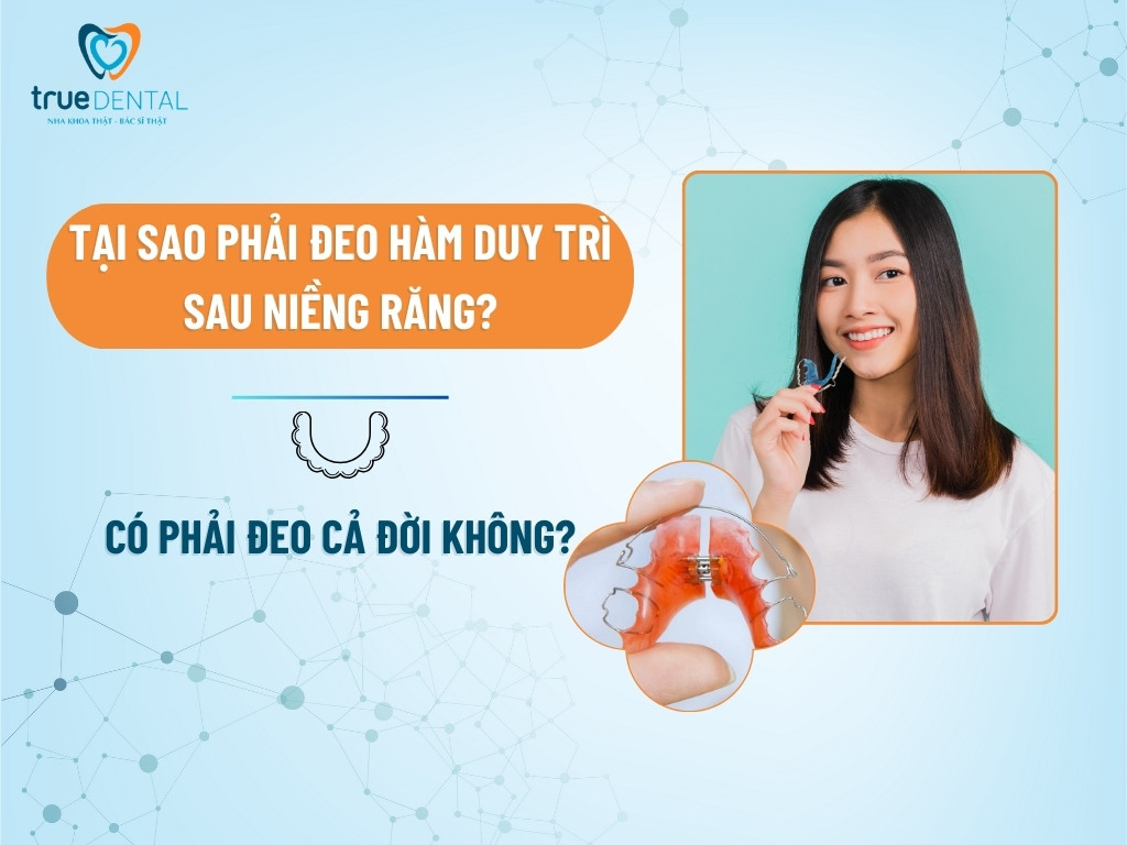 TẠI SAO PHẢI ĐEO HÀM DUY TRÌ SAU NIỀNG RĂNG? CÓ PHẢI ĐEO CẢ ĐỜI KHÔNG?