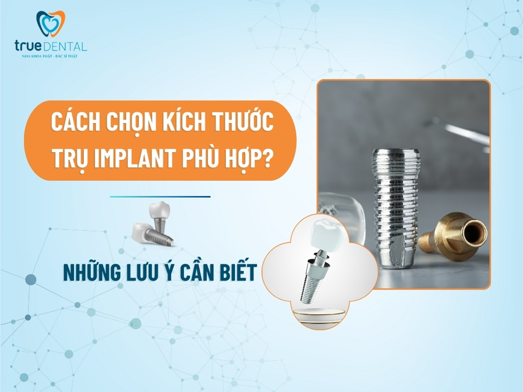 CÁCH CHỌN KÍCH THƯỚC TRỤ IMPLANT PHÙ HỢP? NHỮNG LƯU Ý CẦN BIẾT