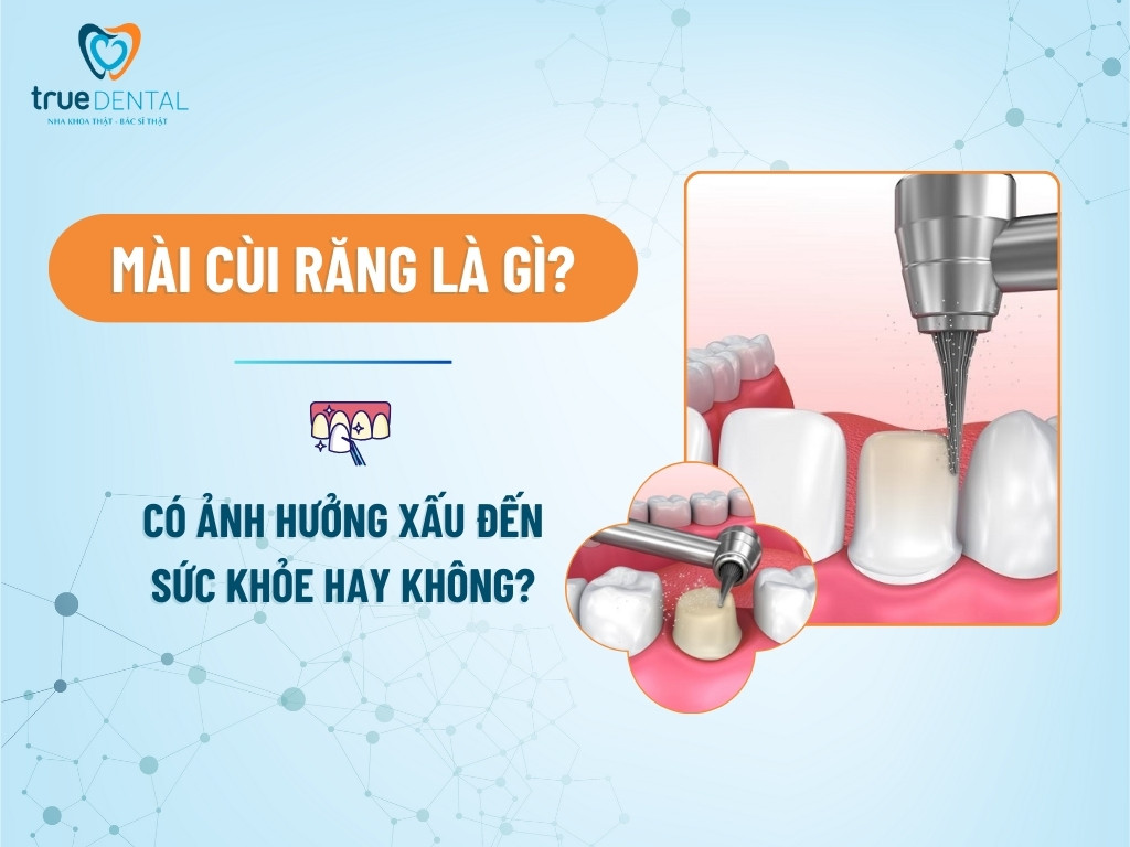 MÀI CÙI RĂNG LÀ GÌ? CÓ ẢNH HƯỞNG XẤU ĐẾN SỨC KHỎE HAY KHÔNG?