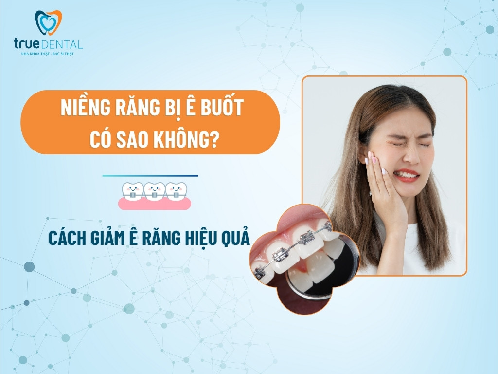 NIỀNG RĂNG BỊ Ê BUỐT CÓ SAO KHÔNG? CÁCH GIẢM Ê RĂNG HIỆU QUẢ