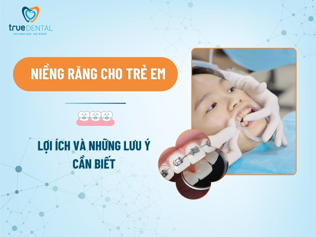 NIỀNG RĂNG CHO TRẺ EM: LỢI ÍCH VÀ NHỮNG LƯU Ý CẦN BIẾT