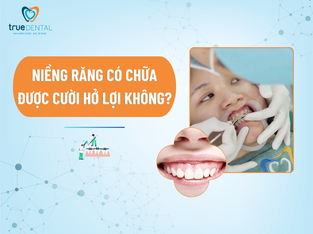 nieng rang co chua duoc cuoi ho loi khong 1