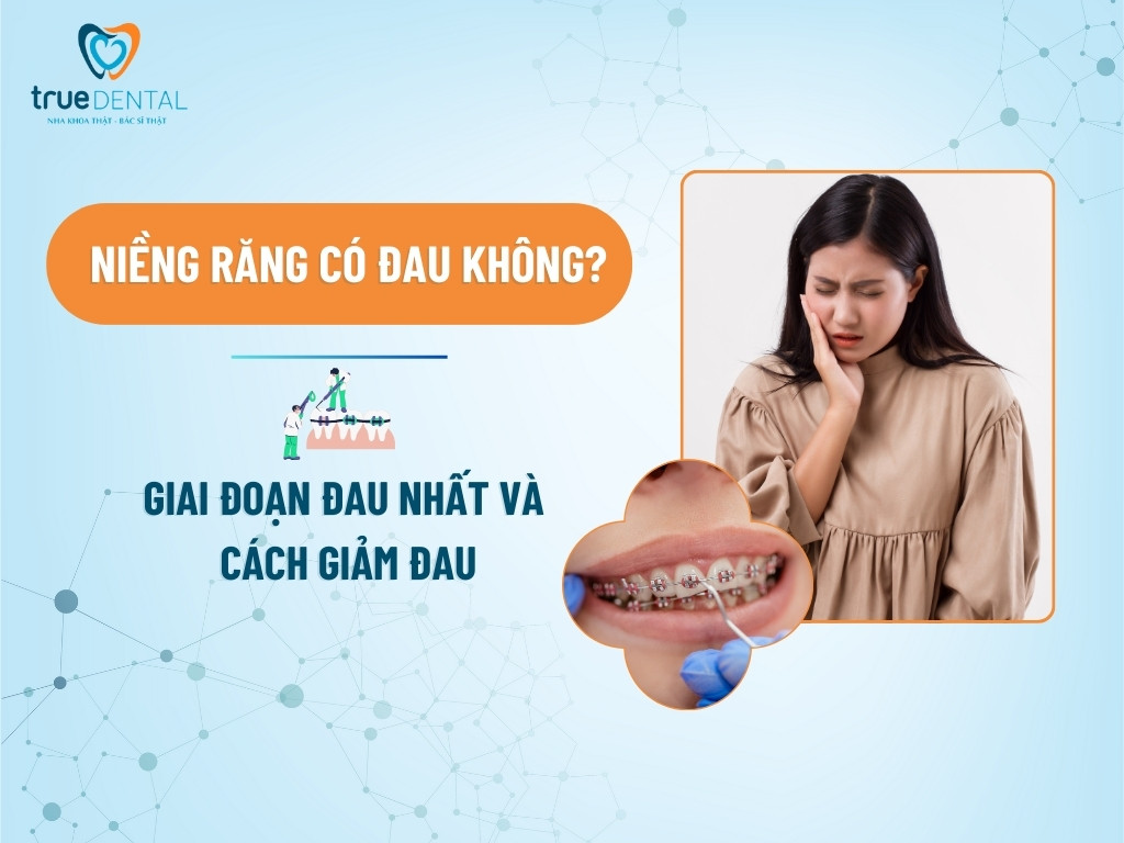 NIỀNG RĂNG CÓ ĐAU KHÔNG? GIAI ĐOẠN ĐAU NHẤT VÀ CÁCH GIẢM ĐAU