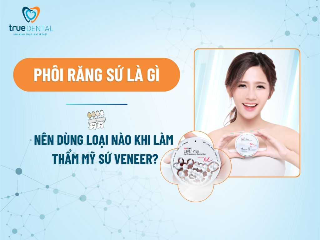 PHÔI RĂNG SỨ LÀ GÌ? NÊN DÙNG LOẠI NÀO KHI LÀM THẨM MỸ SỨ VENEER?