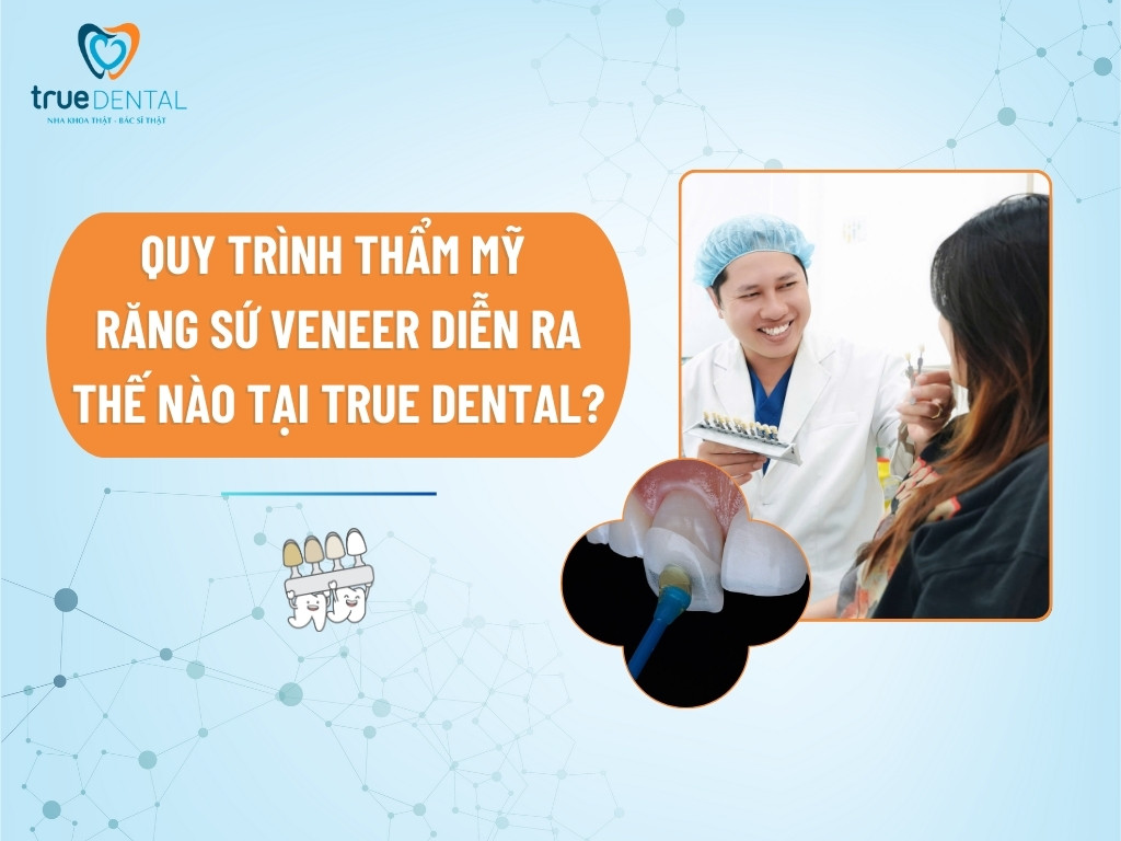 QUY TRÌNH THẨM MỸ RĂNG SỨ VENEER DIỄN RA THẾ NÀO TẠI TRUE DENTAL?