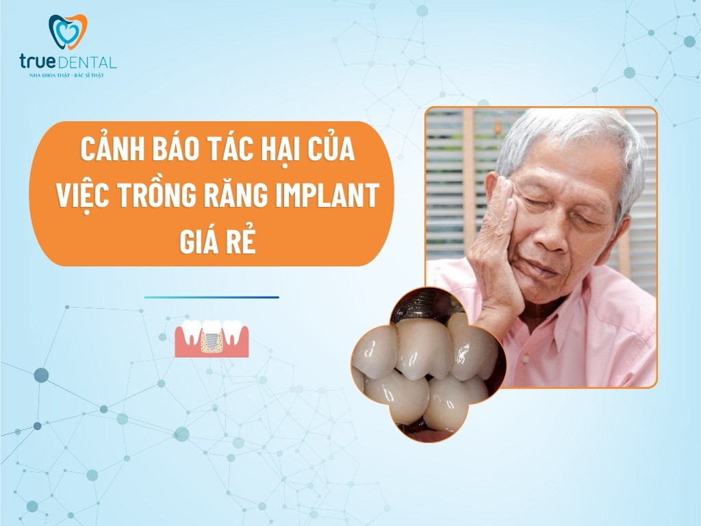 CẢNH BÁO TÁC HẠI CỦA VIỆC TRỒNG RĂNG IMPLANT GIÁ RẺ