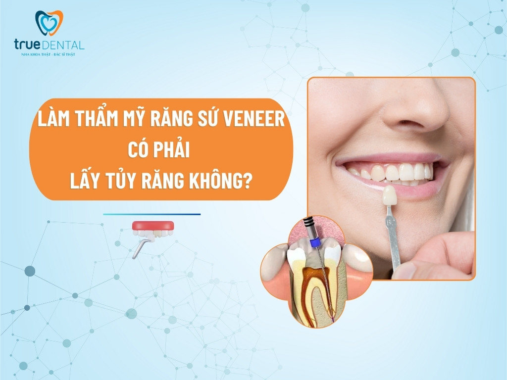 LÀM THẨM MỸ RĂNG SỨ VENEER CÓ PHẢI LẤY TỦY KHÔNG?