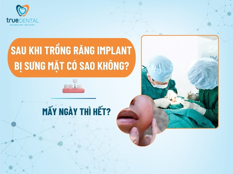 SAU KHI TRỒNG RĂNG IMPLANT BỊ SƯNG MẶT CÓ SAO KHÔNG? MẤY NGÀY THÌ HẾT?