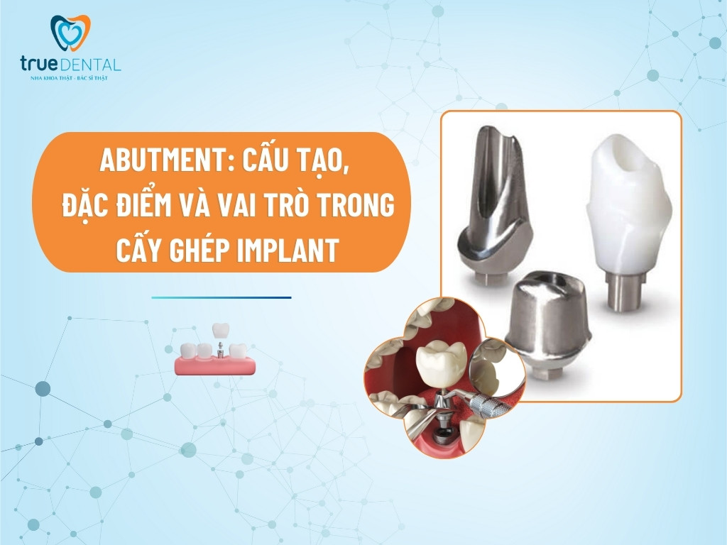 ABUTMENT: CẤU TẠO, ĐẶC ĐIỂM VÀ VAI TRÒ TRONG CẤY GHÉP IMPLANT
