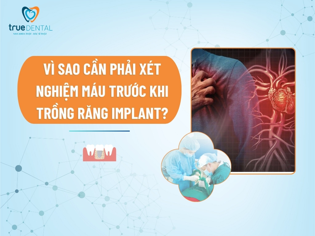 [GIẢI ĐÁP] BỊ BỆNH TIM MẠCH CÓ TRỒNG RĂNG IMPLANT ĐƯỢC KHÔNG?