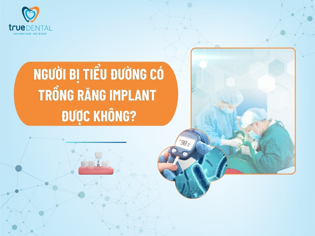 [GIẢI ĐÁP] NGƯỜI BỊ TIỂU ĐƯỜNG CÓ TRỒNG RĂNG IMPLANT ĐƯỢC KHÔNG?