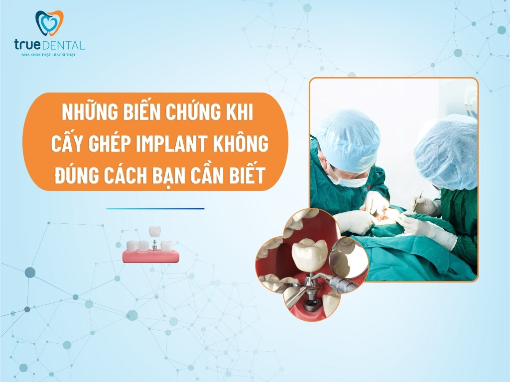 bien chung khi cay ghep implant 1
