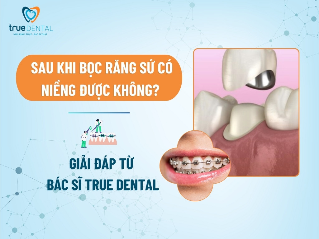 SAU KHI BỌC RĂNG SỨ CÓ NIỀNG ĐƯỢC KHÔNG? GIẢI ĐÁP TỪ BÁC SĨ TRUE DENTAL 6 SAU KHI BỌC RĂNG SỨ CÓ NIỀNG ĐƯỢC KHÔNG? GIẢI ĐÁP TỪ BÁC SĨ TRUE DENTAL