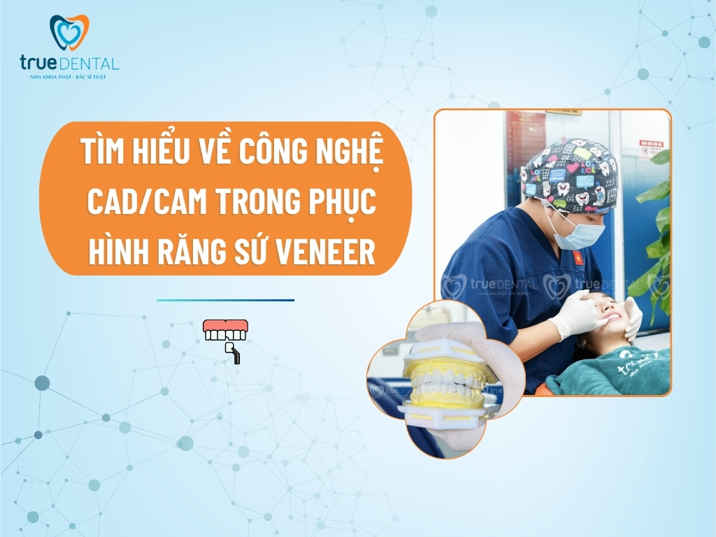 TÌM HIỂU VỀ CÔNG NGHỆ CAD/CAM TRONG PHỤC HÌNH RĂNG SỨ VENEER